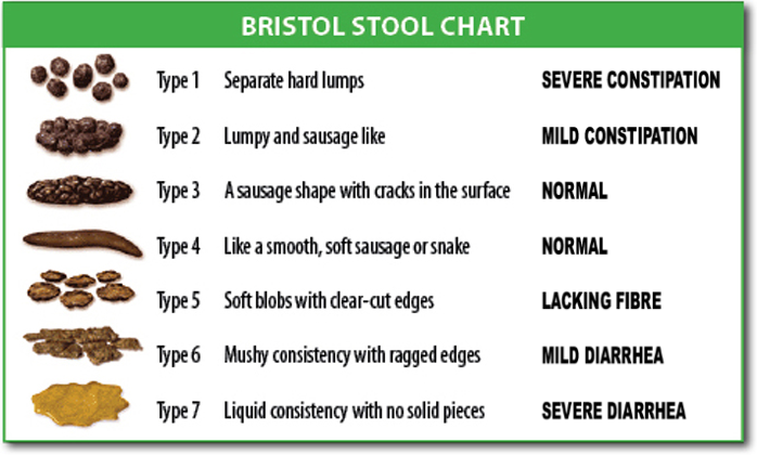11 17 scala bristol