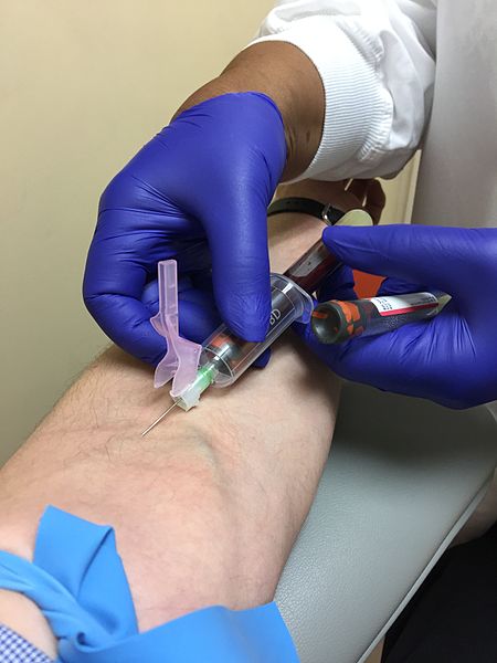 1 1 venipuncture
