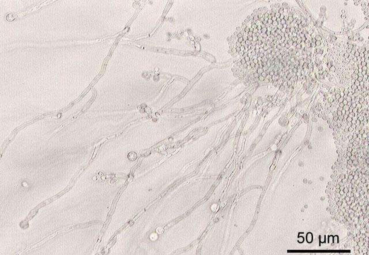 Candida albicans