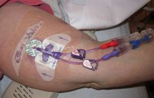 PICC Malkiewicz Judy