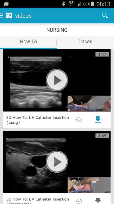 SonoAccess downloads
