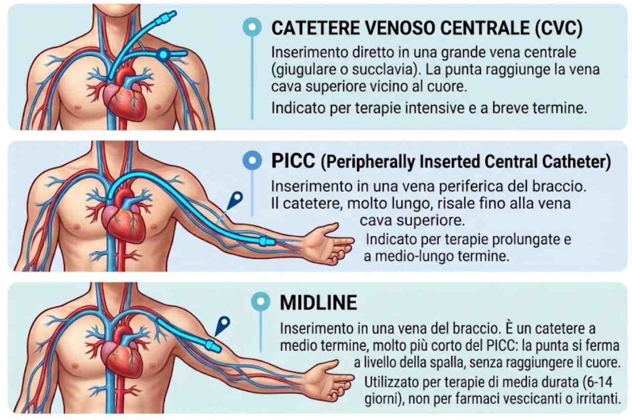 Accessi vascolari