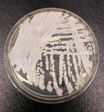 Candida auris, colonie su piastra di Petri