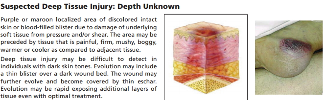 categoria sospetto danno profondo