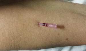 cvp dettaglio tecnica