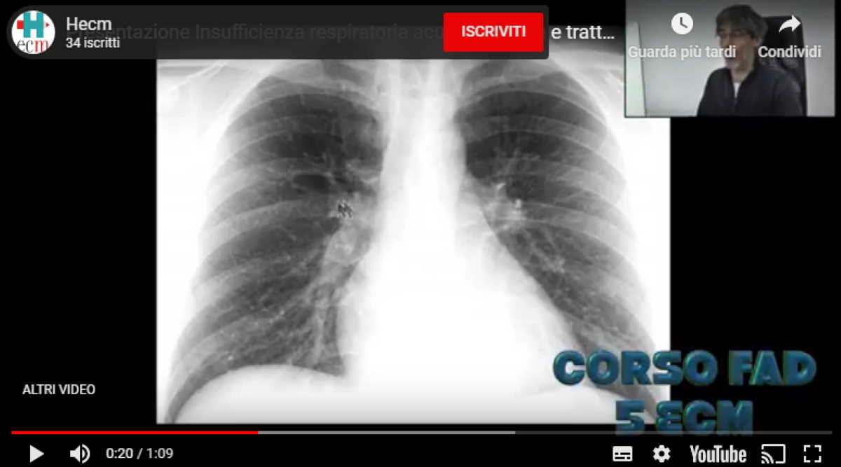 fad insufficienza respiratoria