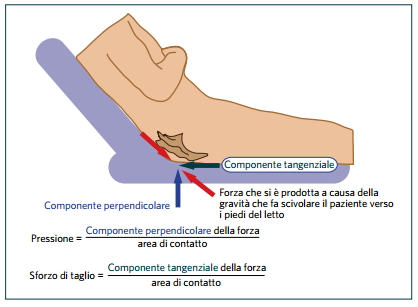 forze lesioni da pressione