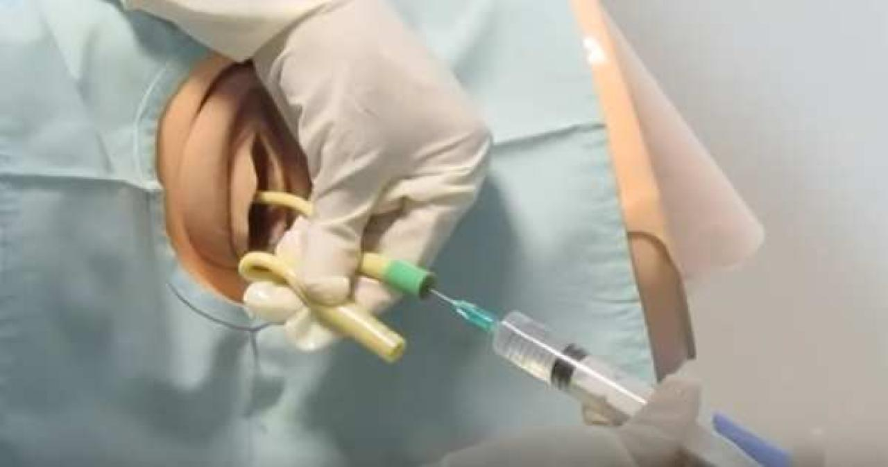 palloncino catetere vescicale