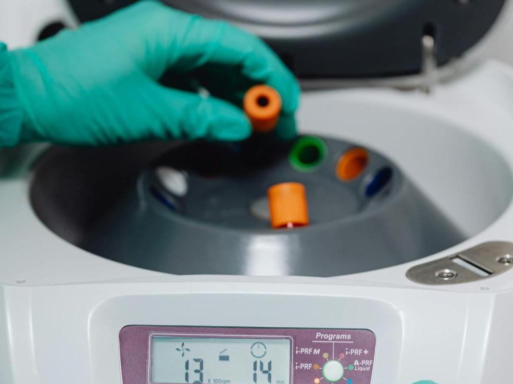 analisi provette ematiche