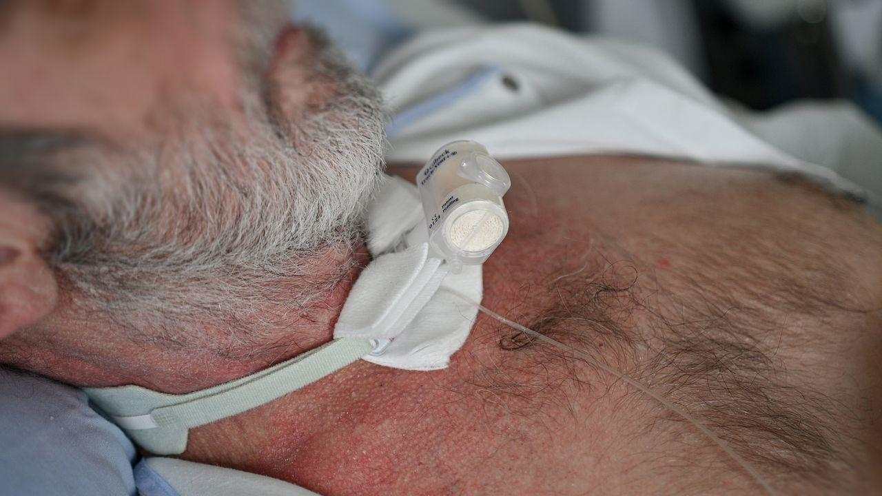 tracheostomia