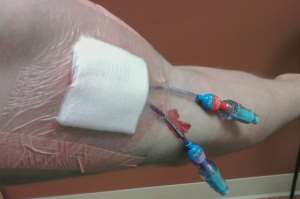 picc braccio medicazione garza