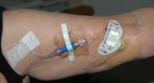 picc medicazione filo sotto la maglietta