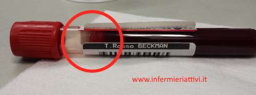 provetta sangue2