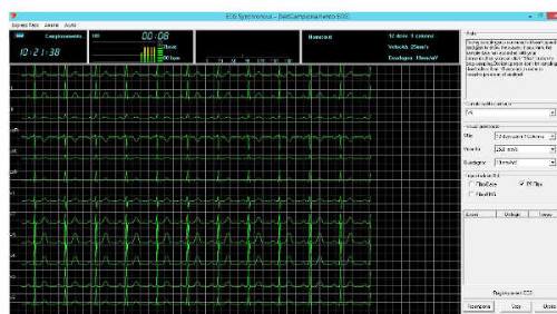 schermata software ecg