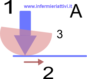 forze lesione tallone